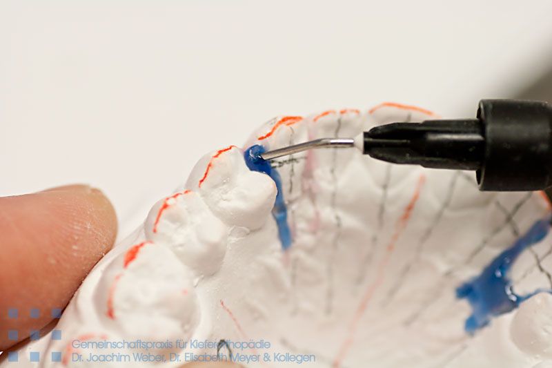 Клиент: zahnspangen.de Фотосъемка. Продвижение картинок.